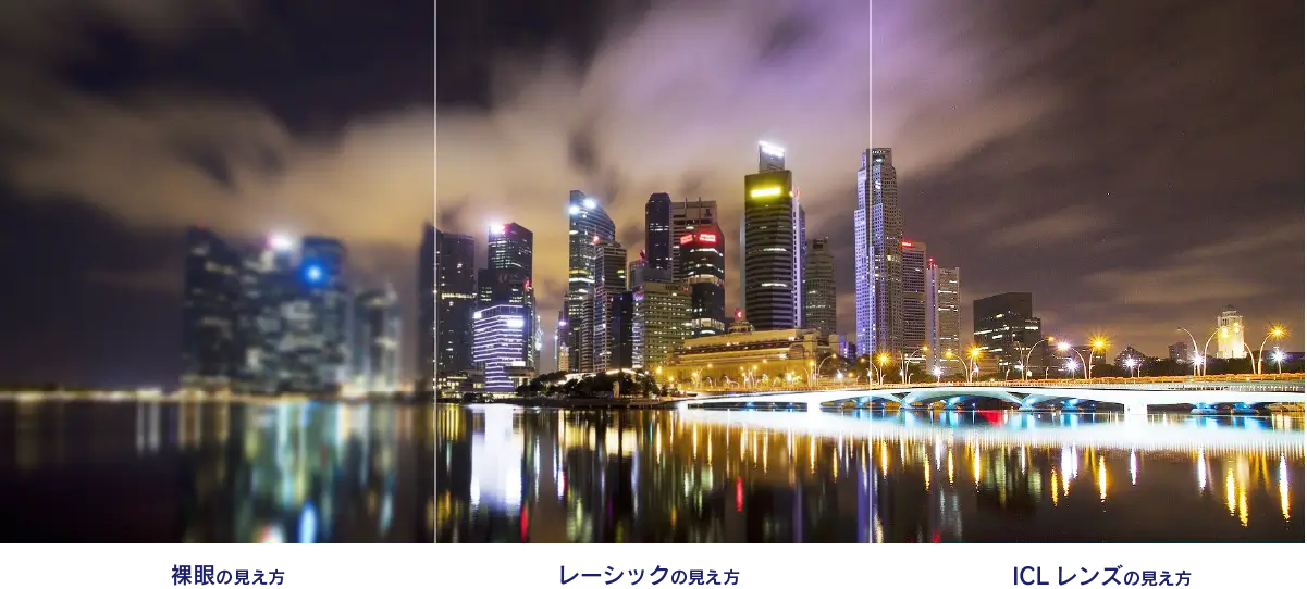 裸眼の見え方/レーシックの見え方/ICLレンズの見え方