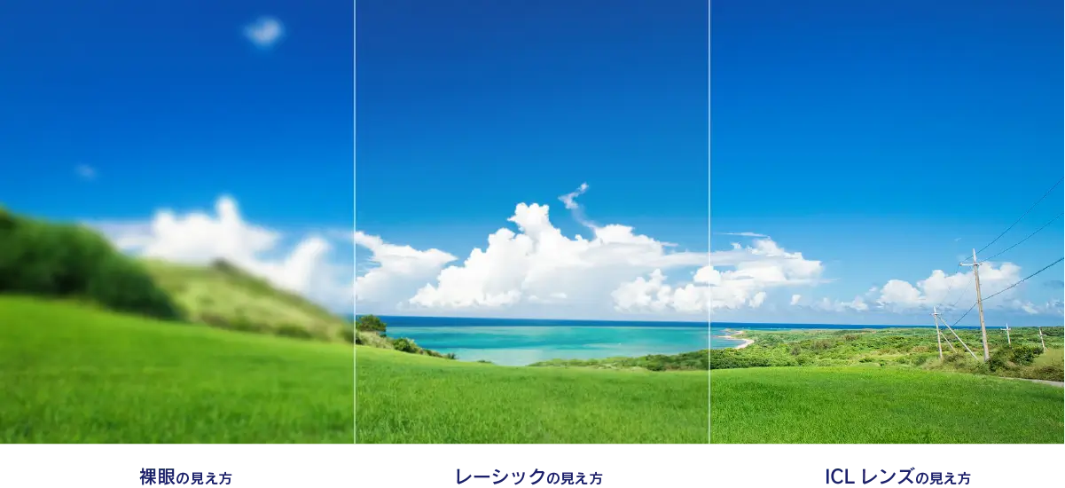 裸眼の見え方/レーシックの見え方/ICLレンズの見え方