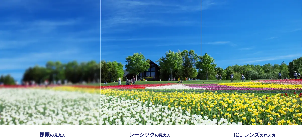 裸眼の見え方/レーシックの見え方/ICLレンズの見え方