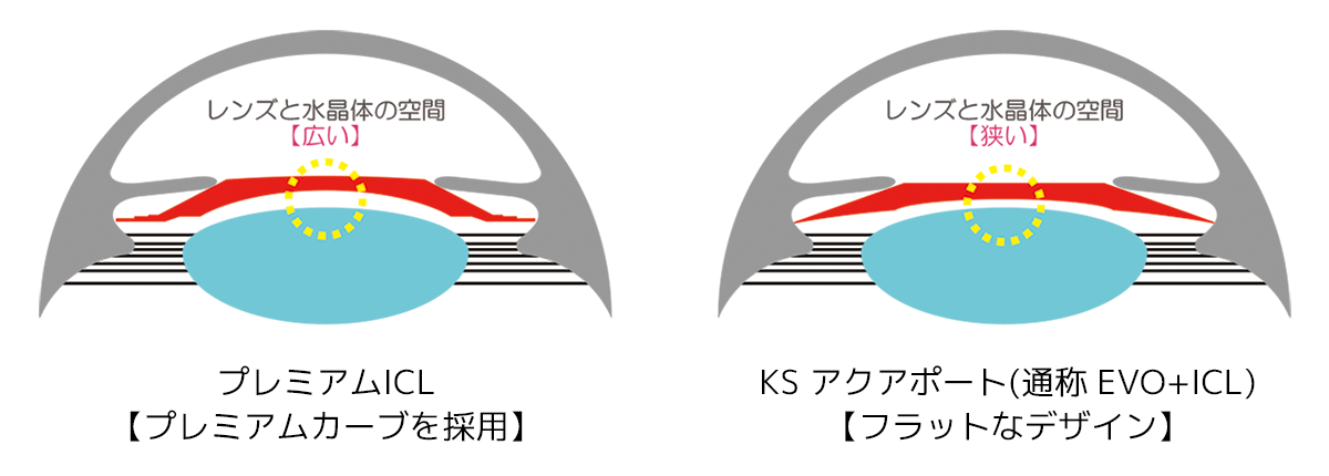 レンズと水晶体の空間