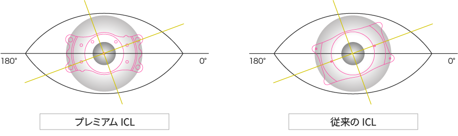 水平状態でレンズを挿入